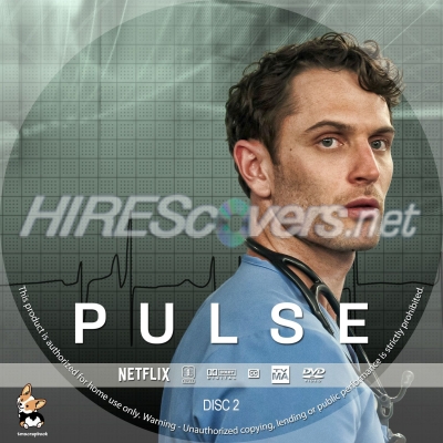 normal Pulse S1D2
