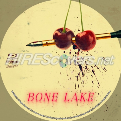 normal Bone Lake BD v3